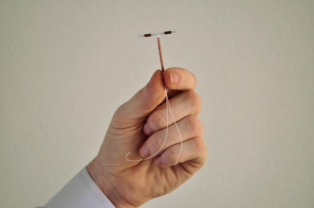 IUD Insertion: What to Expect?